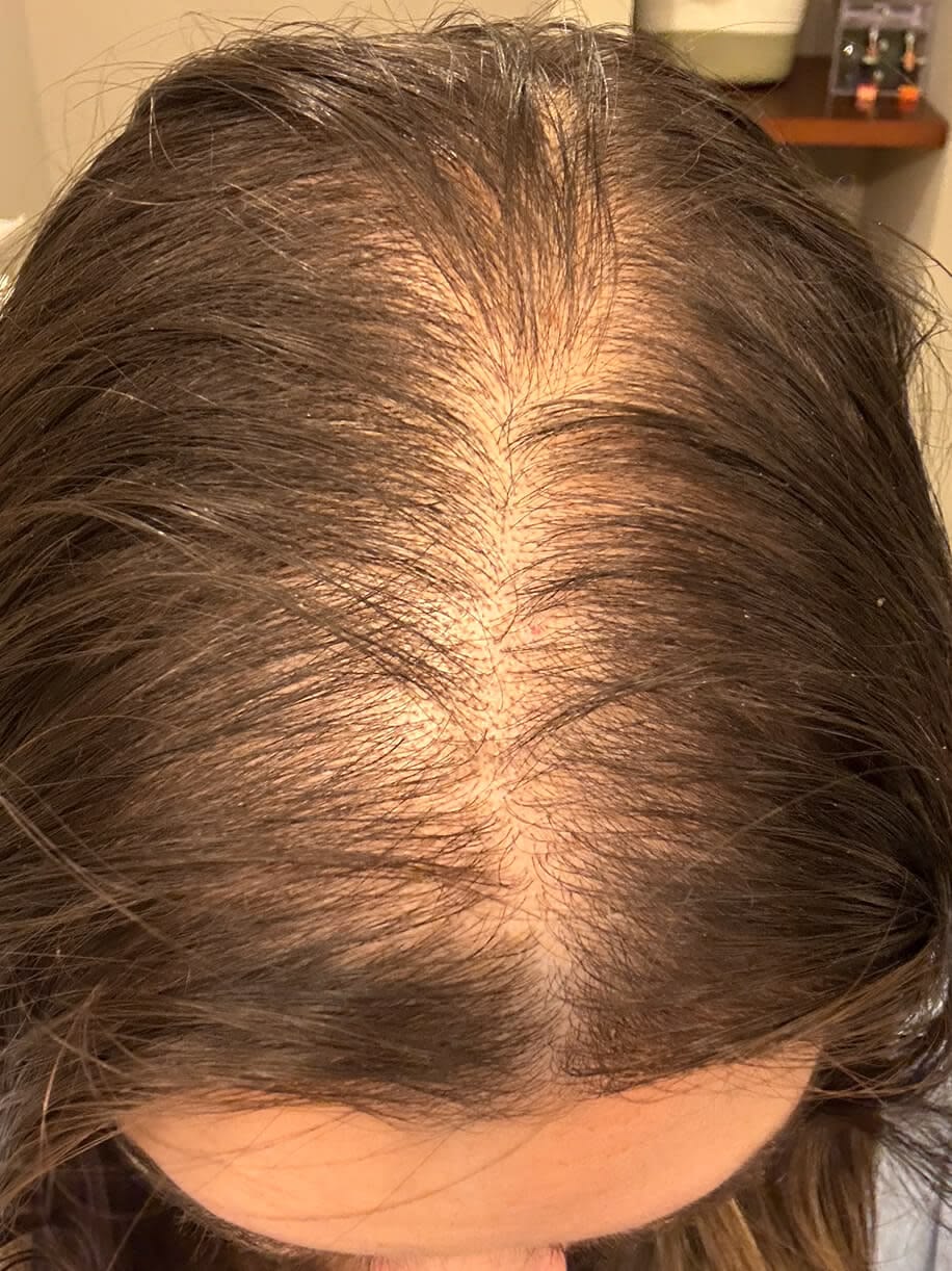 Mariana contando su experiencia con la caída del cabello